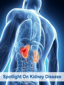 kidney graphic
